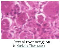 Dorsal root ganglion